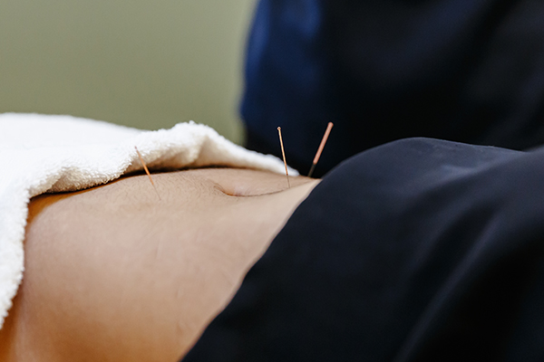 Maag en darmproblemen en acupunctuur Houten